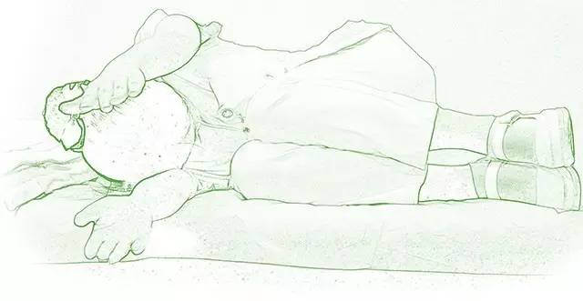 腰肌劳损急性期的恢复训练动作,腰肌劳损可以做什么动作来缓解