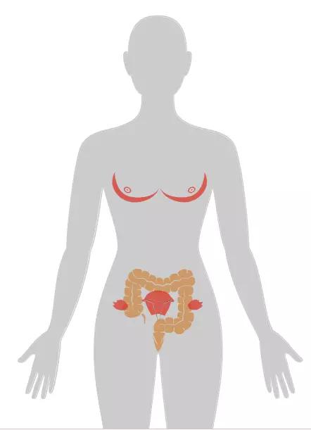 20张癌症人体地图告诉你致癌真相,2020癌症数据报告