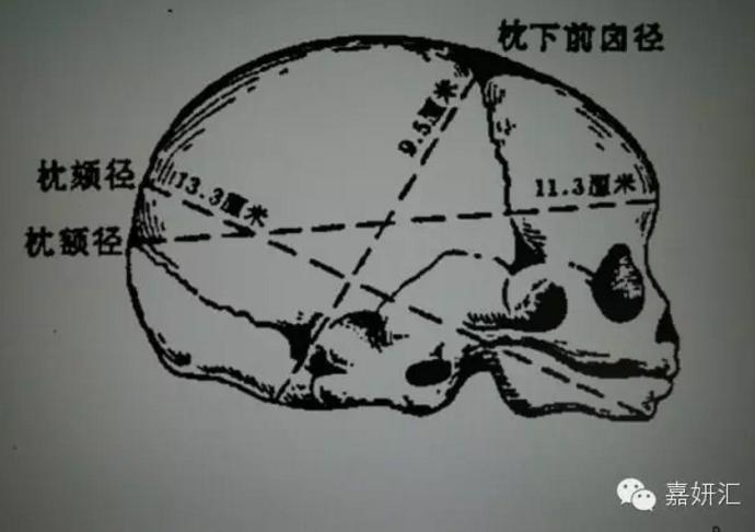 配合医生快速自然分娩,如何快速自然分娩技巧