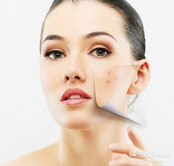 生理期长好多痘痘怎么办,生理期期间荷尔蒙分泌过剩