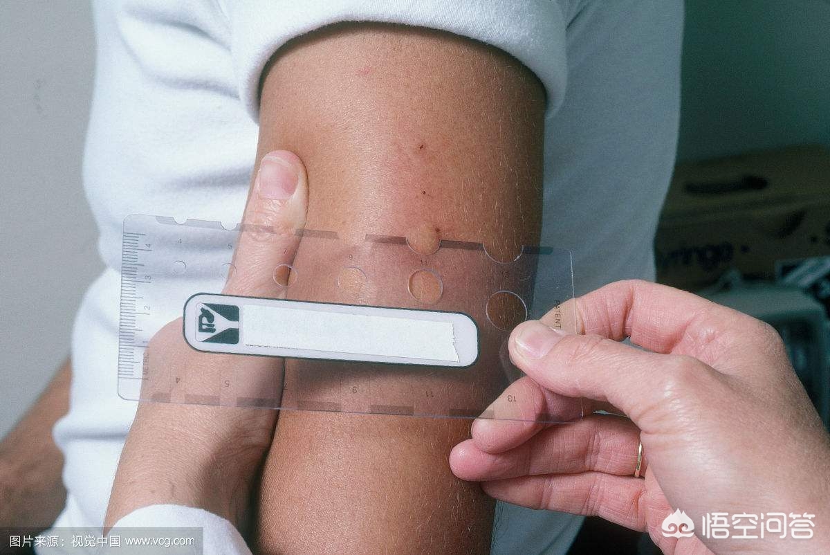 支气管哮喘可以彻底治愈吗,支气管哮喘长期反复发作并发症