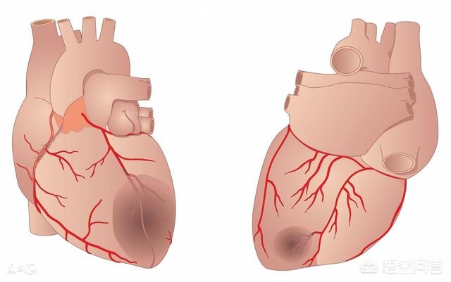 心脏血管堵塞有什么危险？怎样恢复正常？