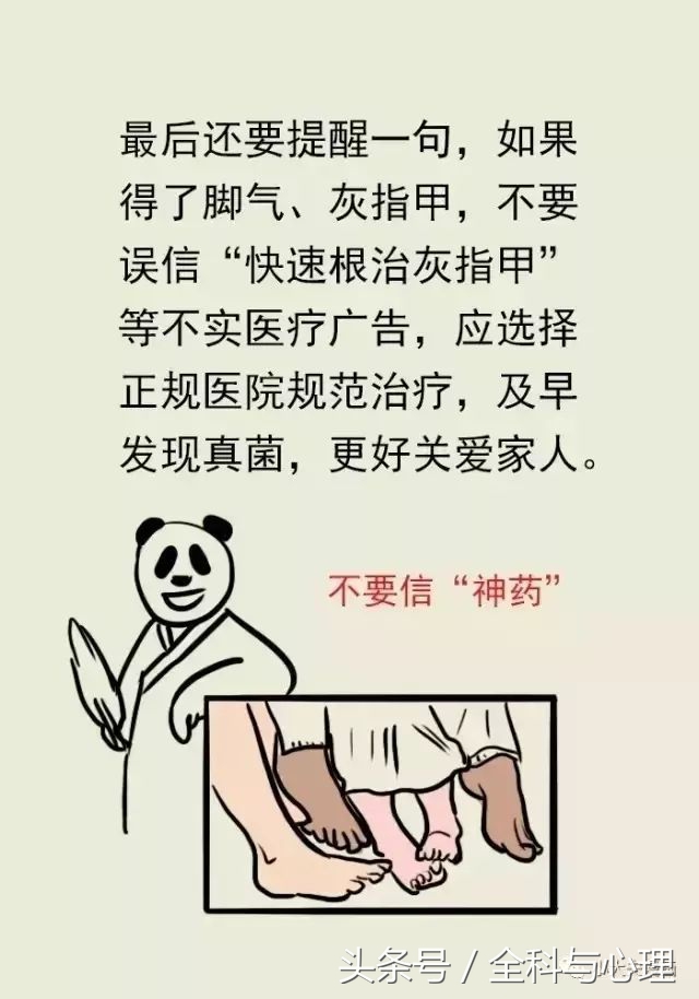 脚气冬天治好还是夏天治疗好,夏天来了脚气提前预防