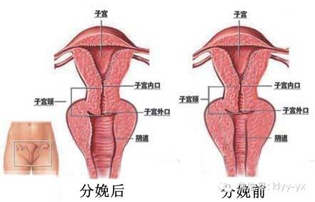生娃后被老公嫌弃了吗,生完孩子后老公嫌弃该怎么办