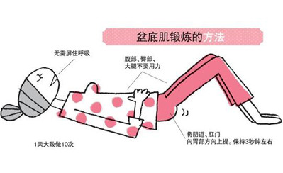 盆底肌锻炼需要长期做吗,盆底肌值得每个女人去重视