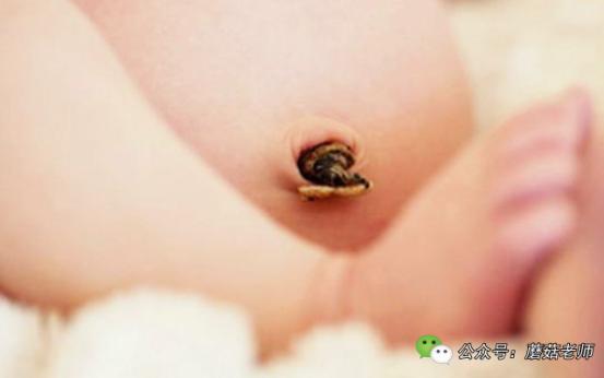 新生儿肚脐出血怎样处理,婴儿肚脐出血怎么护理