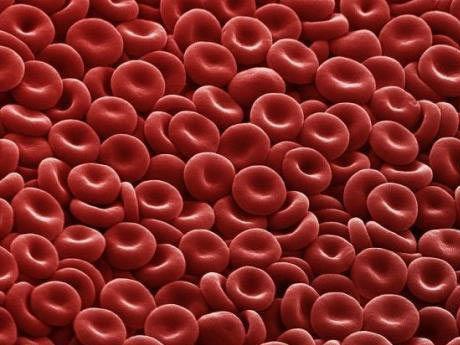 白血病治疗期间血小板升高,白血病血小板有什么用