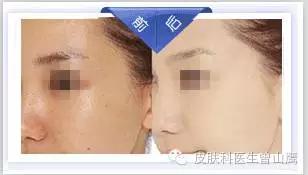 皮肤暗黄怎么办？听听专家怎么说