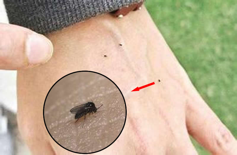 你被蚊子咬了吗是什么梗,四川墨蚊咬了以后怎么治疗