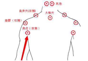 治疗肩周炎三穴一点法,肩周炎治疗时不用点按的穴位
