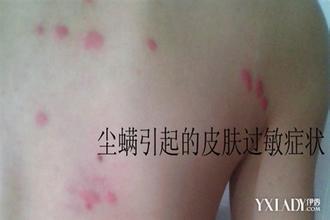 夏季儿童要警惕这几类常见疾病,夏季孩子睡不踏实