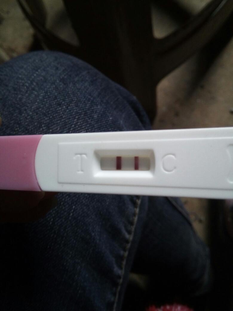 宫颈糜烂重度备孕有影响吗,重度宫颈糜烂宫颈息肉怀孕了