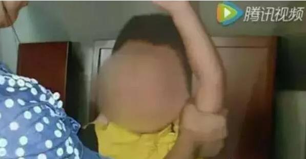 2岁宝宝一夜面瘫了！竟然是因为这个！