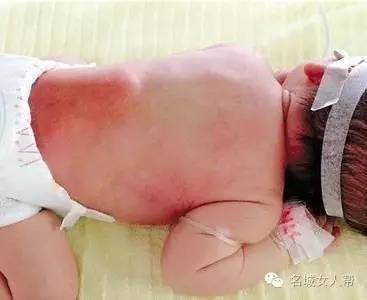 夏季儿童要警惕这几类常见疾病,夏季孩子睡不踏实