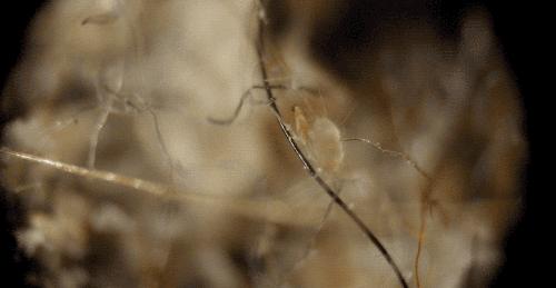 螨虫真的无所不在,螨虫防治小常识