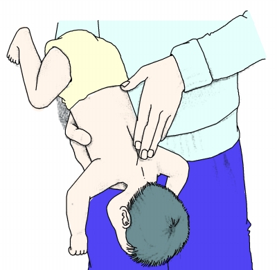 儿童误吞硬币进食道,四岁孩子误吞硬币视频