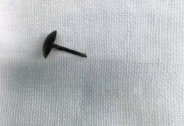 男孩误吞图钉,男孩吞下一枚图钉