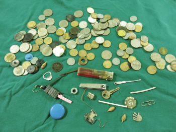 儿童误吞硬币进食道,四岁孩子误吞硬币视频