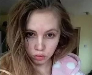 熬夜失眠造成的影响图片,长期失眠人会变丑吗