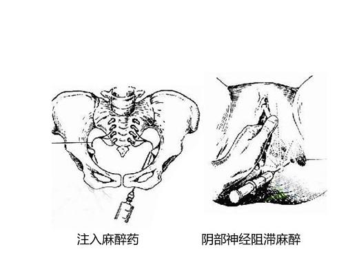 产后顺产妈妈要关注什么问题,侧切妈妈怎么恢复