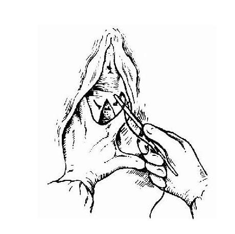 产后顺产妈妈要关注什么问题,侧切妈妈怎么恢复