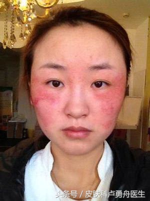 直播间关于面子的话题,直播面子问题