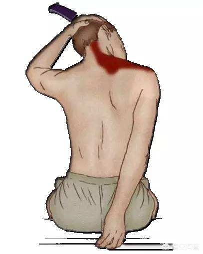 如何改善颈脖前伸,脖子前伸是什么毛病