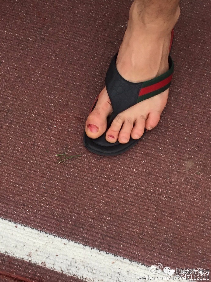 郑铮交叉韧带断裂,郑铮亚冠受伤