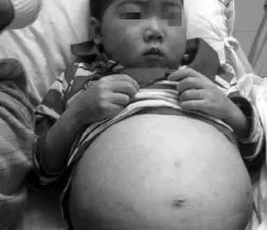 娃娃不长高尽长莽会是“肾病”吗？贵阳晚报“名医讲堂”开讲，招募200名市民免费参与