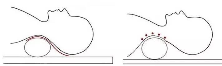 颈椎毛巾卷,一条毛巾怎么护颈椎