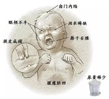 3-6岁儿童腹泻用药,6岁儿童腹泻的快速解决方法