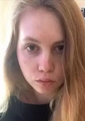 熬夜失眠造成的影响图片,长期失眠人会变丑吗