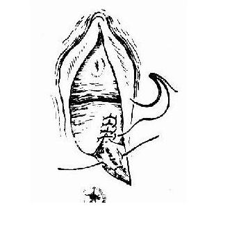 产后顺产妈妈要关注什么问题,侧切妈妈怎么恢复