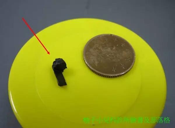 小孩真的什么东西都可以塞进鼻孔？