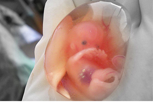 好不容易盼到孩子上学,好不容易等来的宝宝出生