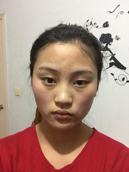 肌肤美白的方法,美白小秘诀