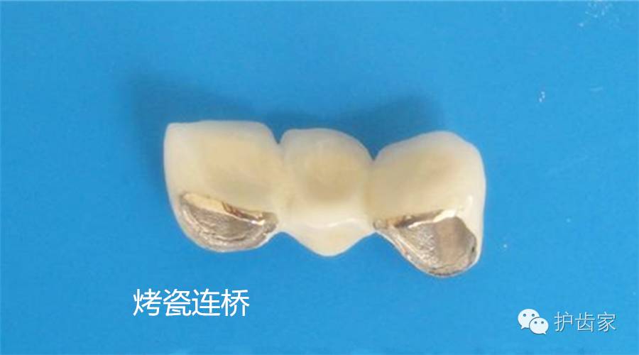 医生，我不谨慎把烤瓷牙吃到肚子里了！咋办啊！