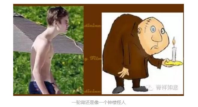 青少年治驼背的最快的方法,纠正青少年驼背快速锻炼方法