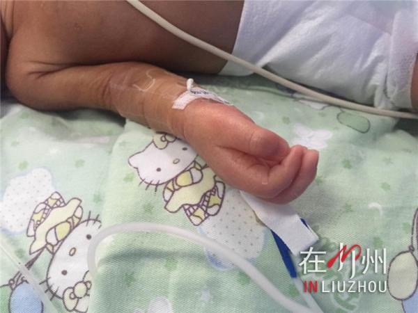 28周早产儿呼吸一直不太好要紧吗,28周早产儿呼吸暂停19次严重