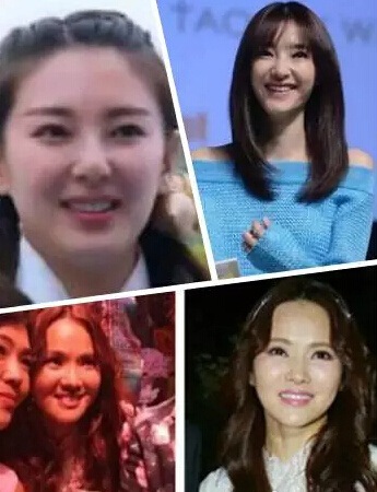 她们“肿”了，都是因为苹果肌惹的祸！