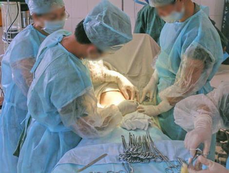 剖腹产的妈妈有多伟大,剖腹产的妈妈最伟大