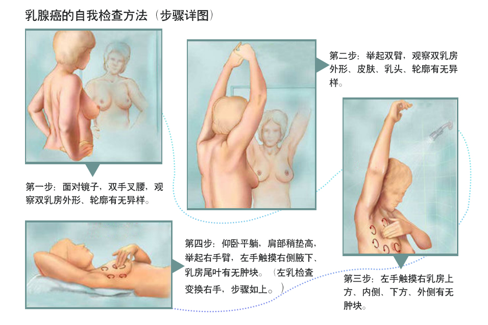 她确诊癌症瞒着所有人成全丈夫,体检发现乳腺癌也是万幸