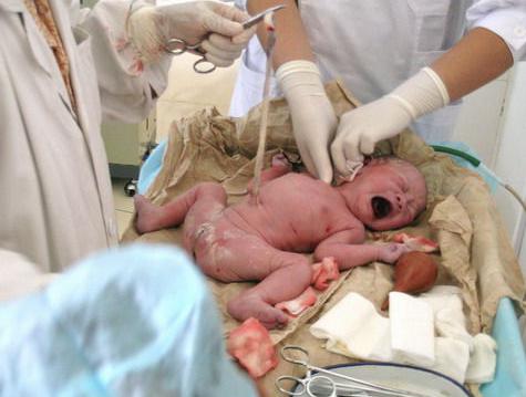 剖腹产的妈妈有多伟大,剖腹产的妈妈最伟大