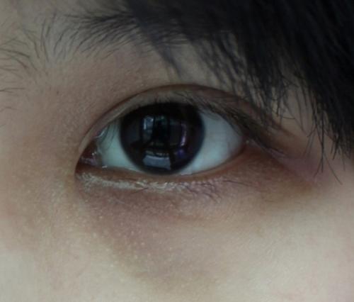 缓解黑眼圈的食品,睡觉能缓解黑眼圈