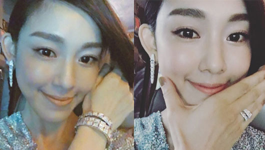 她们“肿”了，都是因为苹果肌惹的祸！