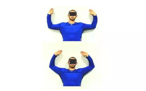 肩部撞击症,肩部撞击怎么康复