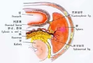 他外伤后脾破裂腹腔出血，妻子的一句话他拒绝了医生住院要求。