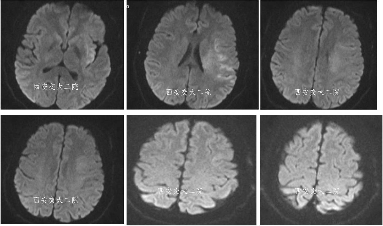 介入科病例,介入手术的健康科普方案