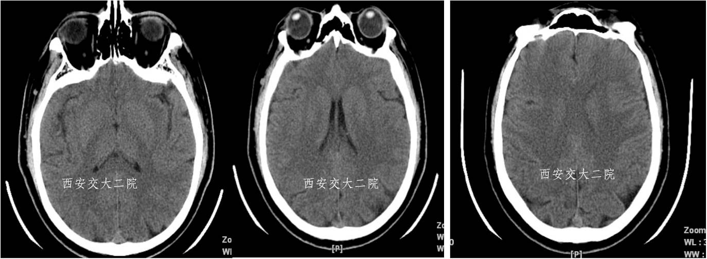 介入科病例,介入手术的健康科普方案