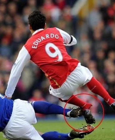 2022年世界体坛十大精彩事件,世界十大恐怖断腿集锦